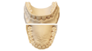 Rășină pentru modele de restaurare dentară